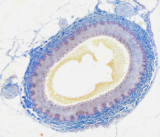 artery-micro-stained-epithel-yellow.jpg