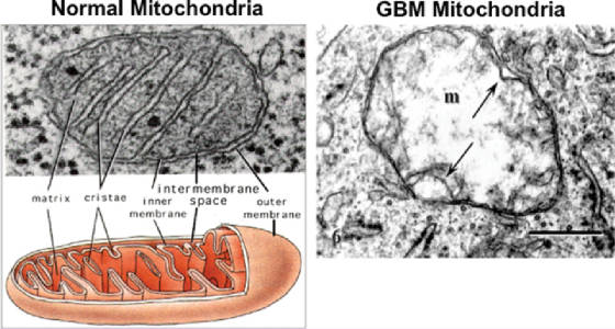 mitochondrial-struct-seyfried.jpg