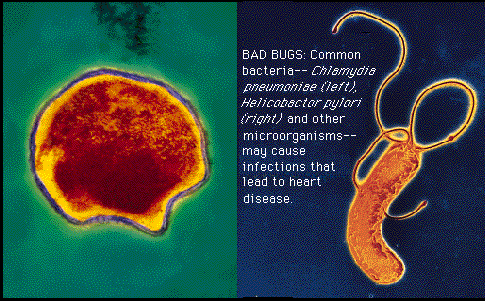 bacteria-arteriosclorsis.gif